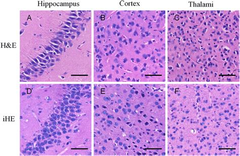 Comparison Of IHE And Traditional H E Staining AC Images Of