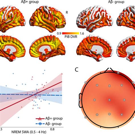 β amyloid Aβ burden and sleep related cognitive reserve in the Aβ