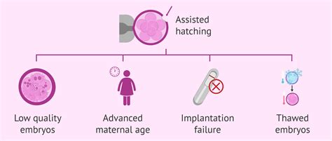 Recomendations Hatching Assisted