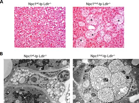 Hematopoietic Npc Mutation Shifts Gut Microbiota Composition In Ldlr