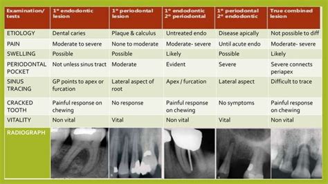 endodontics periodontal lesions pptx dental health diseases