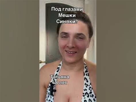 Мешки и синяки под глазами - YouTube