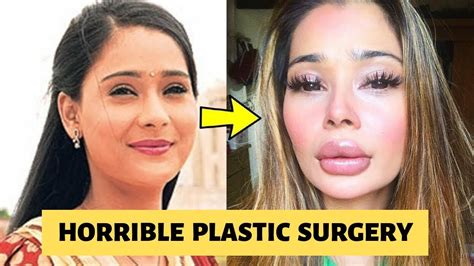 Actress Before And After Plastic Surgery