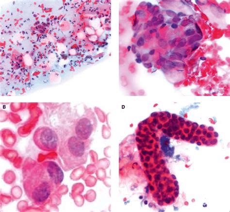 A Cytological Smears Were Characterised By Plasmacytoid Cells In A Download Scientific Diagram