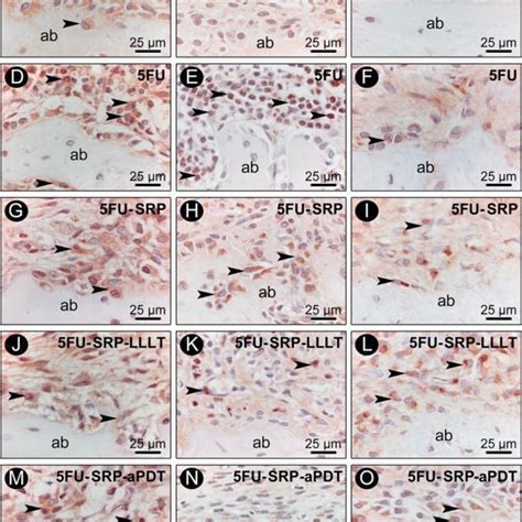 Immunolabeling Pattern For Trap Rankl And Opg In Furcation Region Of