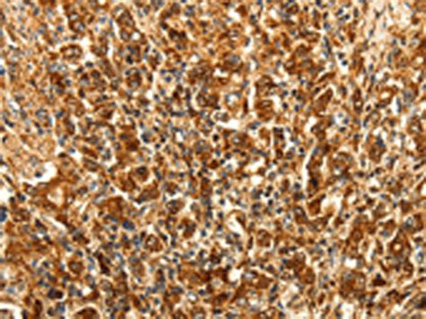 Map Lc A Anti Map Lc A Rabbit Polyclonal Antibody