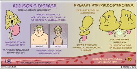 Primary Hyperaldosteronism | Nursing notes, Nursing school studying ...