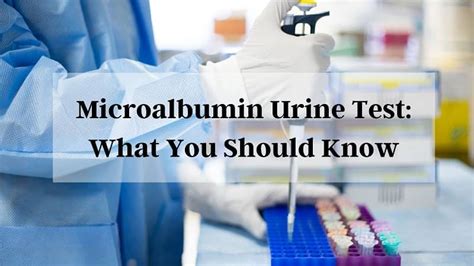 How Urine Microalbumin Helps To Test Correct Albumin-Level