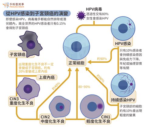 子宮頸癌50因病毒感染 定期抹片檢查你做了嗎？