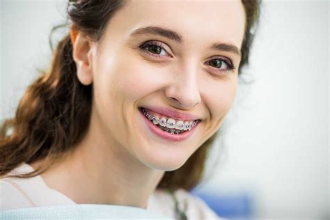 Signs You Need Dental Braces Again Orthodontics Texas