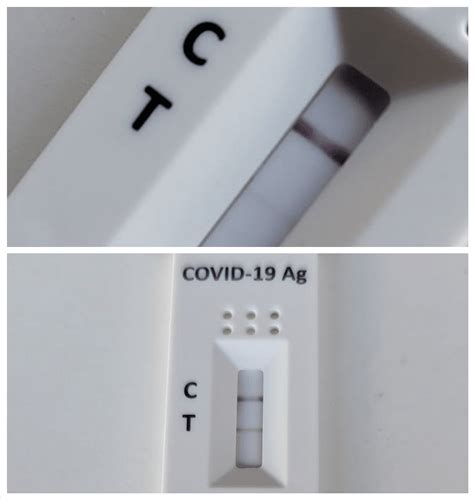 Cómo Interpretar Un Test De Antígenos En Casa Y Qué Son Los Positivos