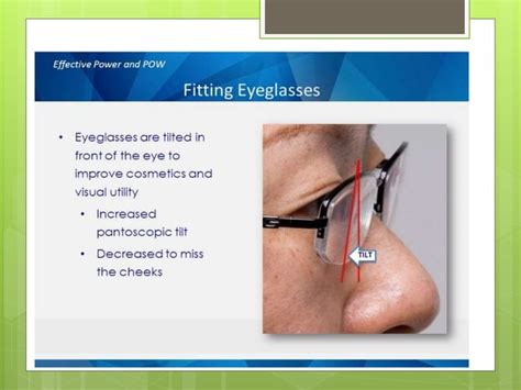 Pantoscopic Tilt Ppt