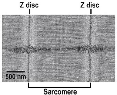 Transmission Electron Micrograph Of A Sarcomere Transmission Electron