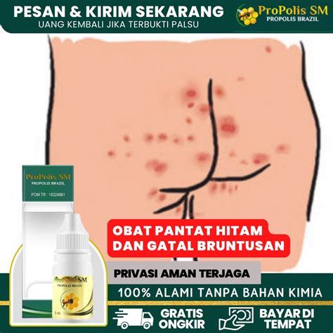 Jual Obat Pantat Hitam Obat Pantat Burik Obat Pantat Bruntusan