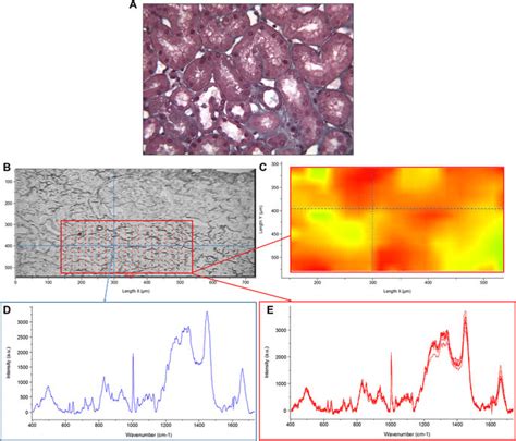 Raman Image Together With Extracted Raman Spectra Originated From A M3