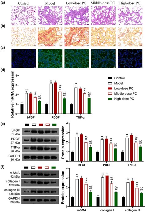 Pc Inhibits The Activation Of Wntβ Catenin Signaling Pathway In Download Scientific Diagram