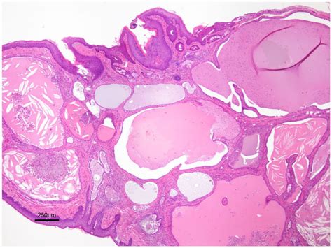 Feline Cystadenomatosis Affecting The Ears And Skin Of 57 Cats 2011