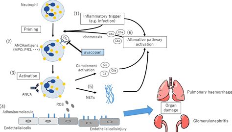 Frontiers The Complement System And ANCA Associated Vasculitis In The