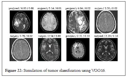 Identification Of Brain Tumor Detection From Mri Image Using Conv