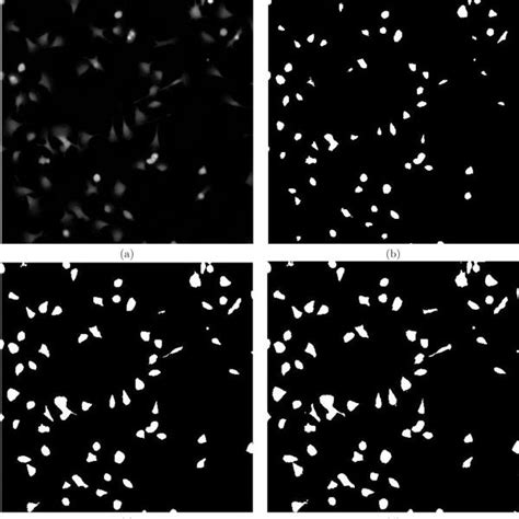 Comparison Of Level Set Segmentation With Otsu S And Fuzzy C Means