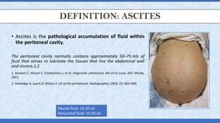 Ascites Part Pdf