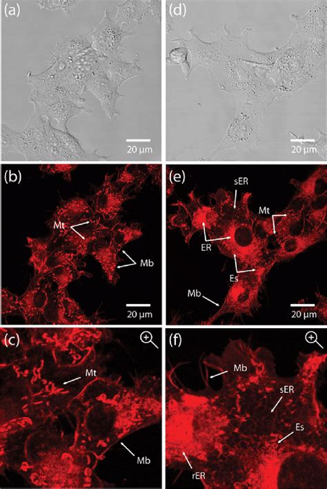 Confocal Images Of Living HeLa Cells Labeled With Compound 6 C A D