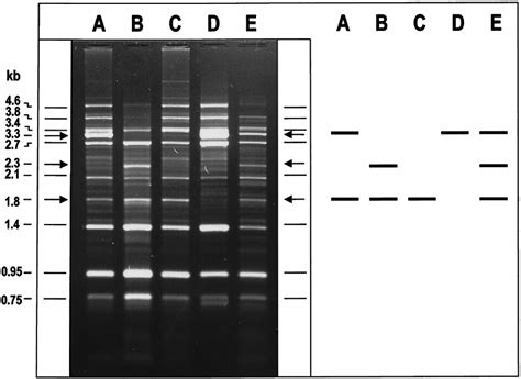 Lr Rep Pcr Fingerprint Patterns Of B Anthracis Strains Representing