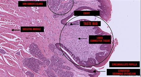 circumvallate-papilla-slide-labelled-histology | SchoolWorkHelper