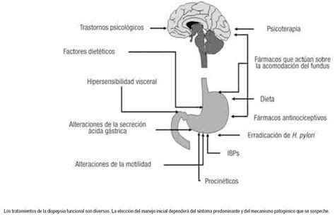 Dispepsia funcional Revista de Gastroenterología de México