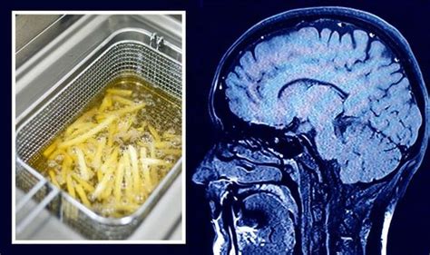 Dementia Diet 3 Foods To Remove From Your Diet To Help Halt Dementia