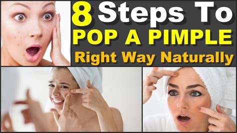 How To To Pop A Pimple Fast In A Right Way Naturally Steps Youtube