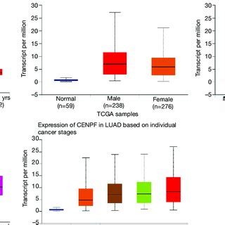 The Expression Of CENPF In Different Subgroups Of LUAD Patients A