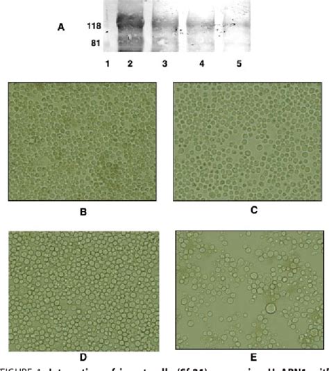 Figure 1 From Knockdown Of Aminopeptidase N From Helicoverpa Armigera