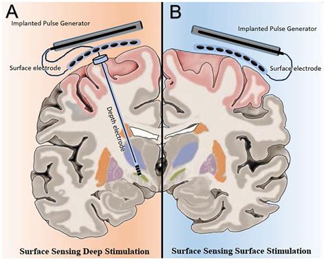 Frontiers Perspective Phase Amplitude Couplingbased Phasedependent