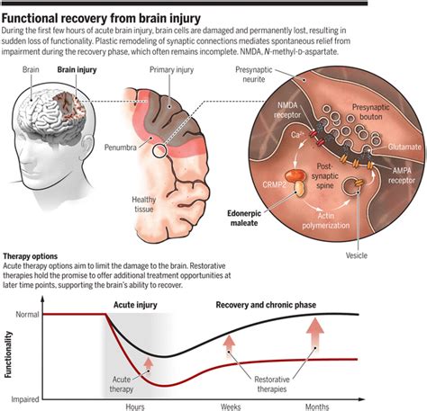 Supporting Recovery From Brain Injury Science