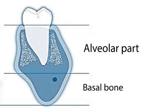 Tooth Extraction Healing Implantation Part