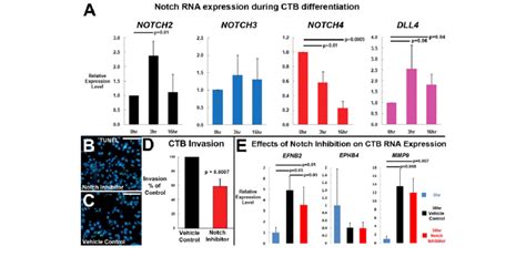 Notch Inhibition Reduced Ctb Invasion And Efnb2 Expression In Vitro