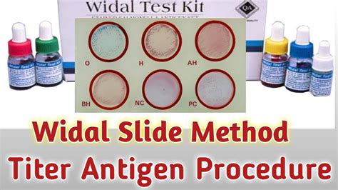 Slide Agglutination Test Procedure