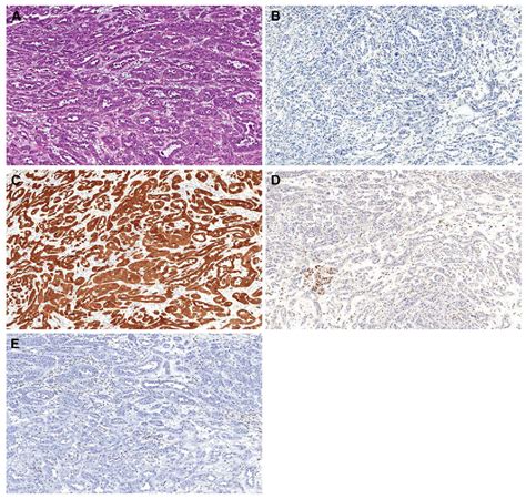 Figure 1 From Application Of Immunohistochemistry And Molecular