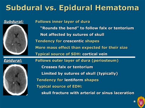 Ppt Introduction To Neuroimaging Powerpoint Presentation Free