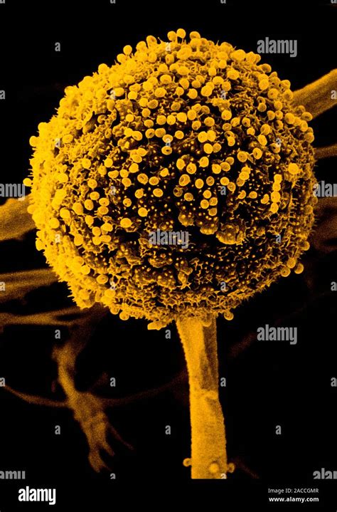 False Colour Scanning Electron Micrograph Of A Sporangium Or Fruiting