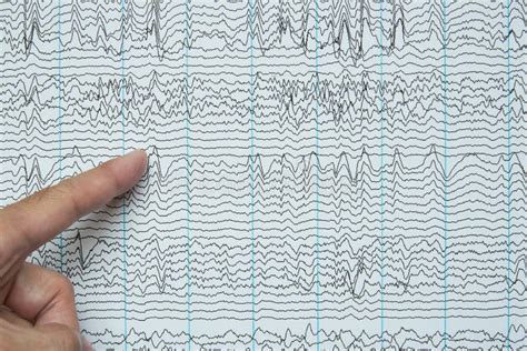 Imaging of Electroencephalography Recording of Human Stock Photo ...