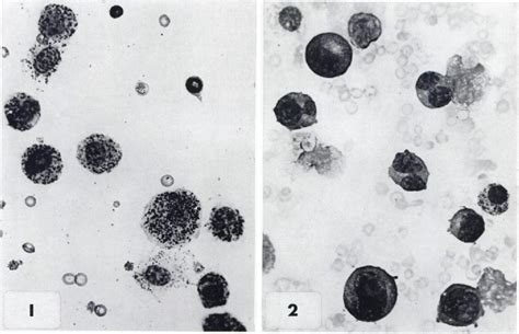 Pdf Studies On The Pathogenesis Of Plasma Cell Tumors Effects Of Sex