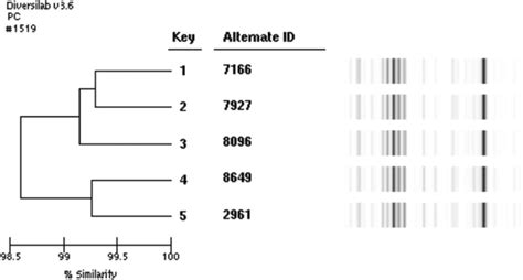 Genetic Typing With Repetitive Sequence Based Pcr Rep Pcr Dendrogram