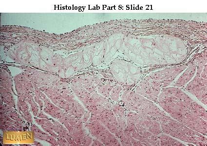 Endocardium Histology