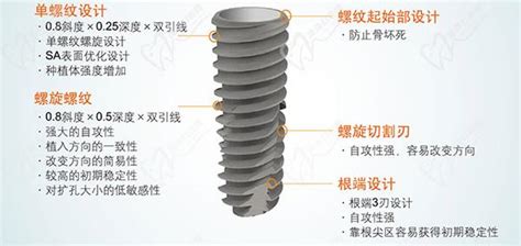 韩国奥齿泰种植体型号介绍，4种型号图谱优势及寿命全解析口腔行业资讯皓齿口腔网