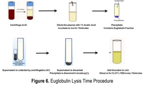 Fibrinolysis Assays Flashcards Quizlet