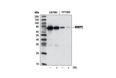 Mmp 2 D8n9y Rabbit Mab Cell Signaling Technology