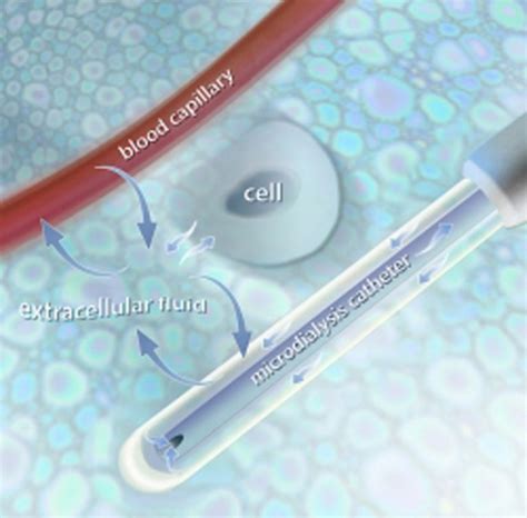 The principle of microdialysis – M Dialysis