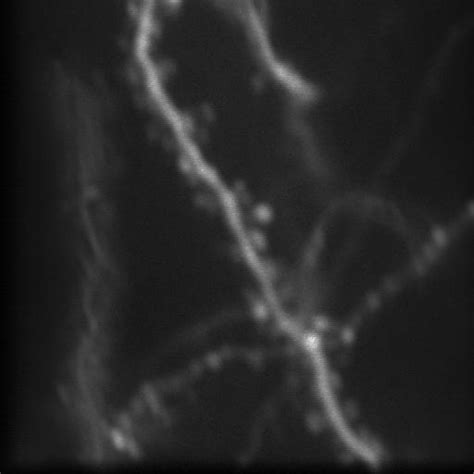 Dendrite spines classification - Roboflow Universe